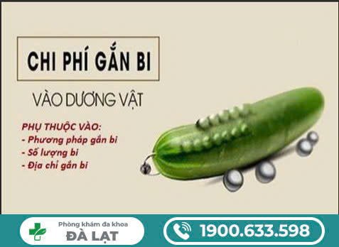 Hình ảnh minh họa